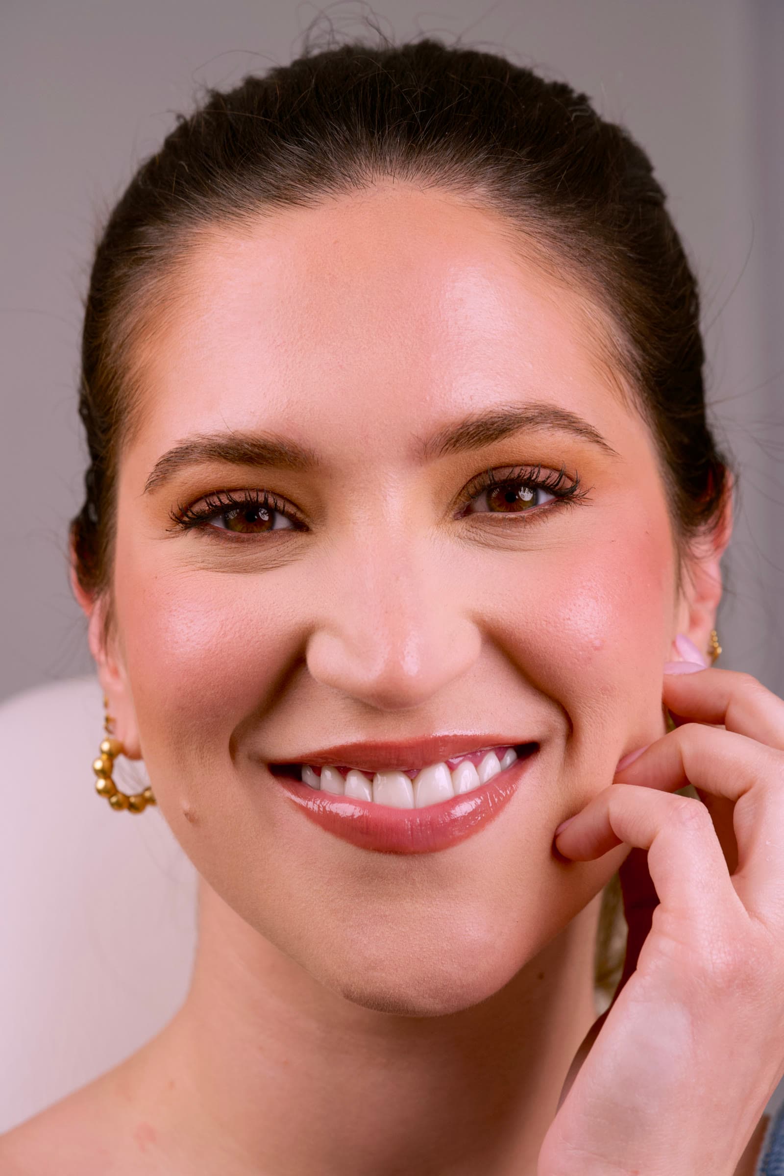 Transformed smile