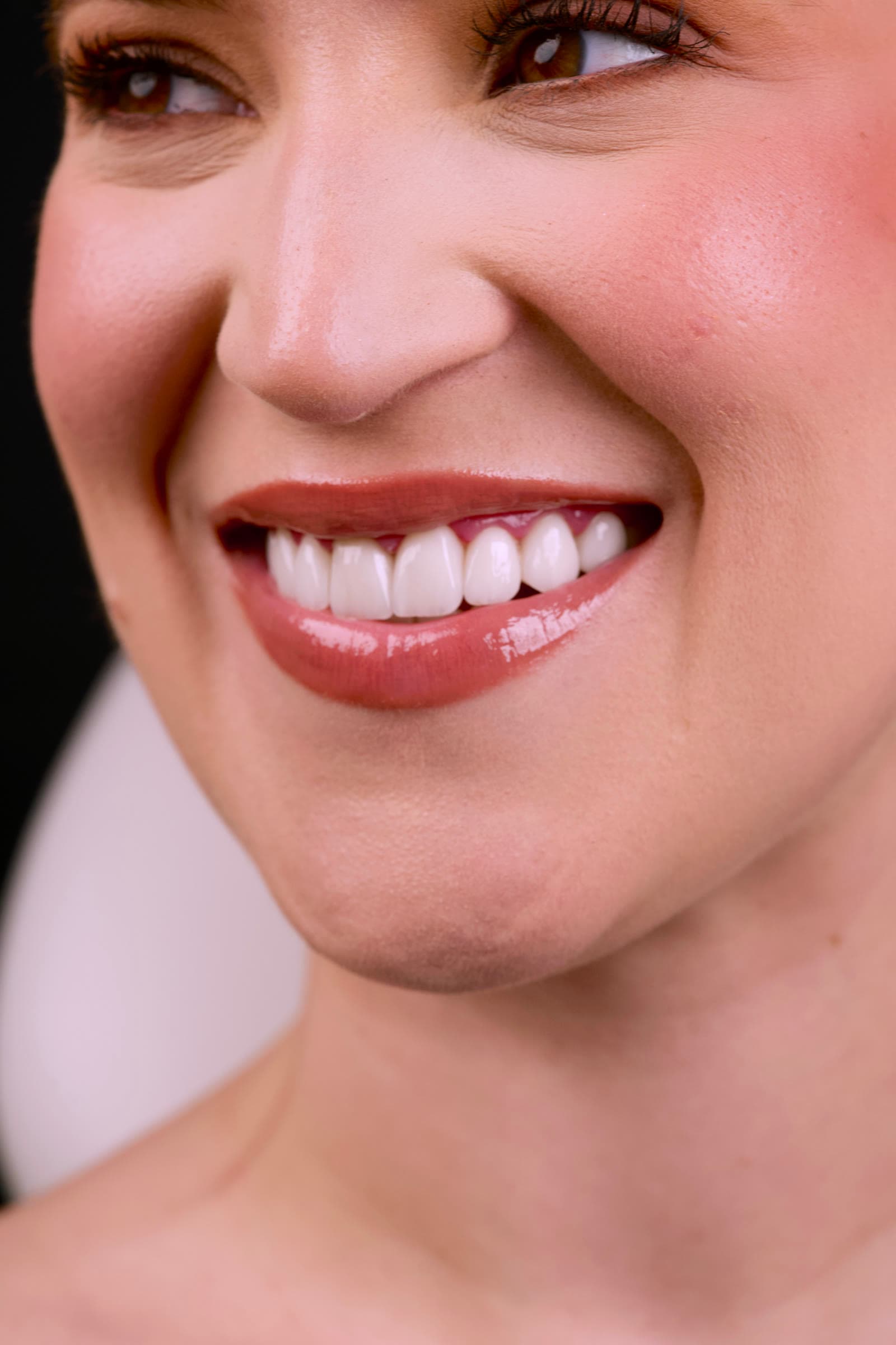 Smile result